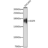 Western Blot - Anti-EGFR Antibody (A92587) - Antibodies.com
