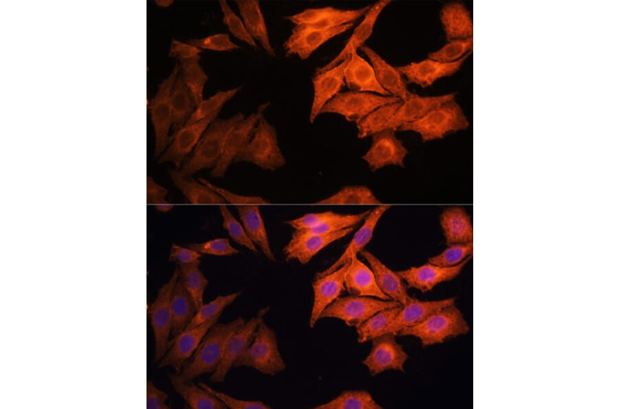 Immunofluorescence - Anti-EGFR Antibody (A92587) - Antibodies.com