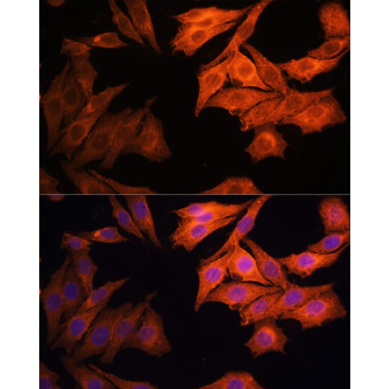 Immunofluorescence - Anti-EGFR Antibody (A92587) - Antibodies.com