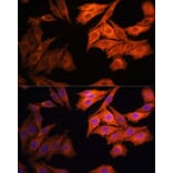 Immunofluorescence - Anti-EGFR Antibody (A92587) - Antibodies.com