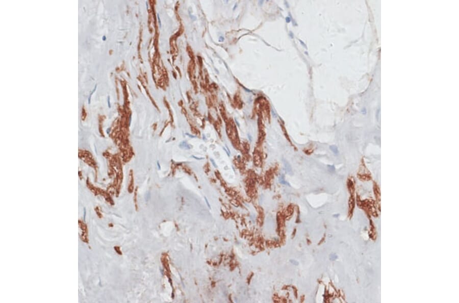 Immunohistochemistry - Anti-Elastin Antibody (A92588) - Antibodies.com