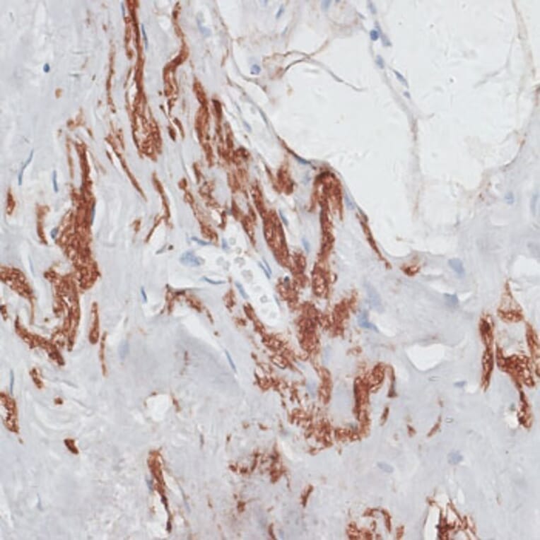Immunohistochemistry - Anti-Elastin Antibody (A92588) - Antibodies.com