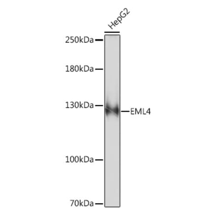 Western Blot - Anti-EML4 Antibody (A92590) - Antibodies.com