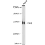 Western Blot - Anti-EML4 Antibody (A92590) - Antibodies.com
