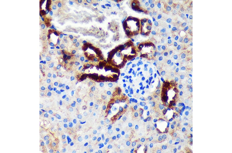 Immunohistochemistry - Anti-EML4 Antibody (A92590) - Antibodies.com