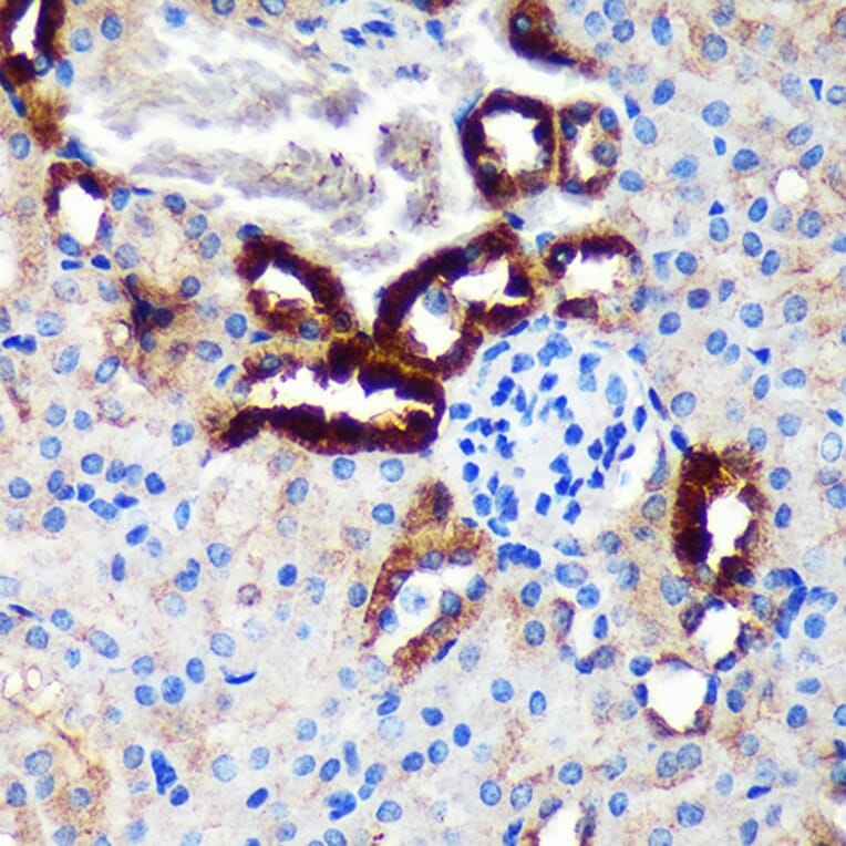 Immunohistochemistry - Anti-EML4 Antibody (A92590) - Antibodies.com