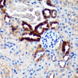 Immunohistochemistry - Anti-EML4 Antibody (A92590) - Antibodies.com