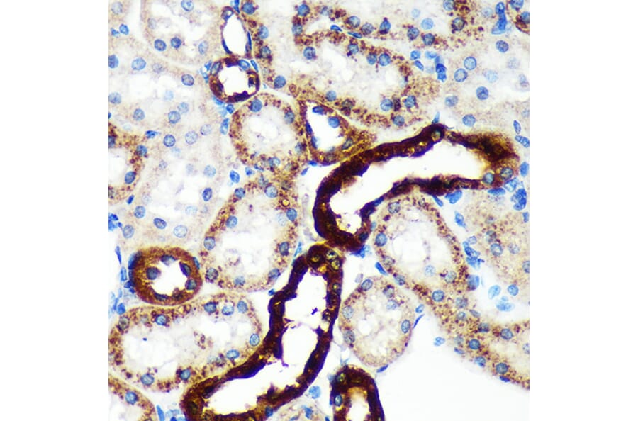 Immunohistochemistry - Anti-EML4 Antibody (A92590) - Antibodies.com