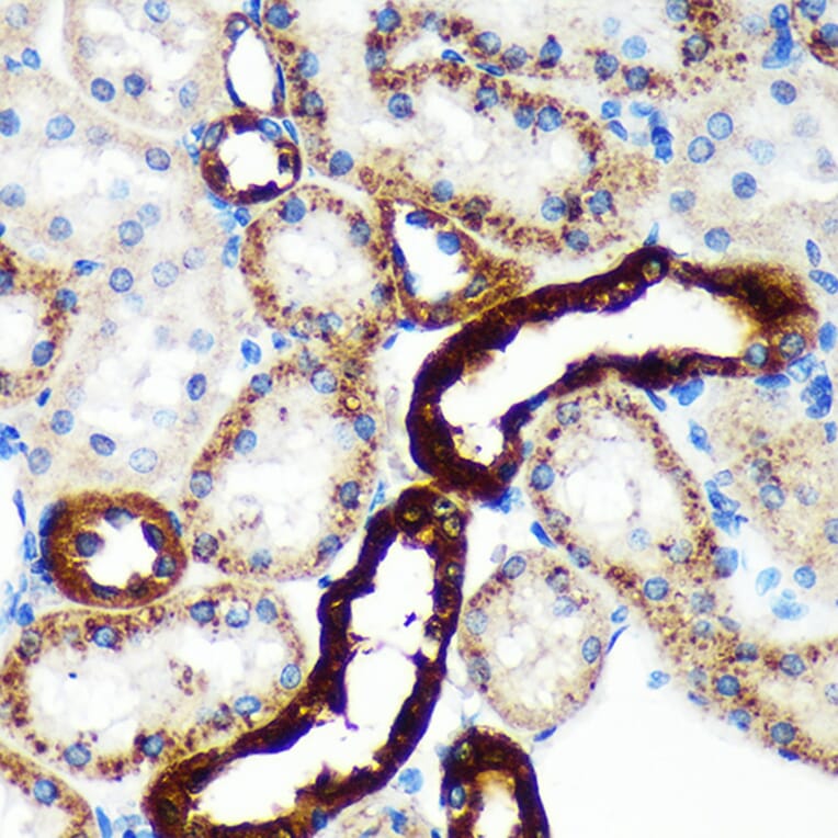 Immunohistochemistry - Anti-EML4 Antibody (A92590) - Antibodies.com