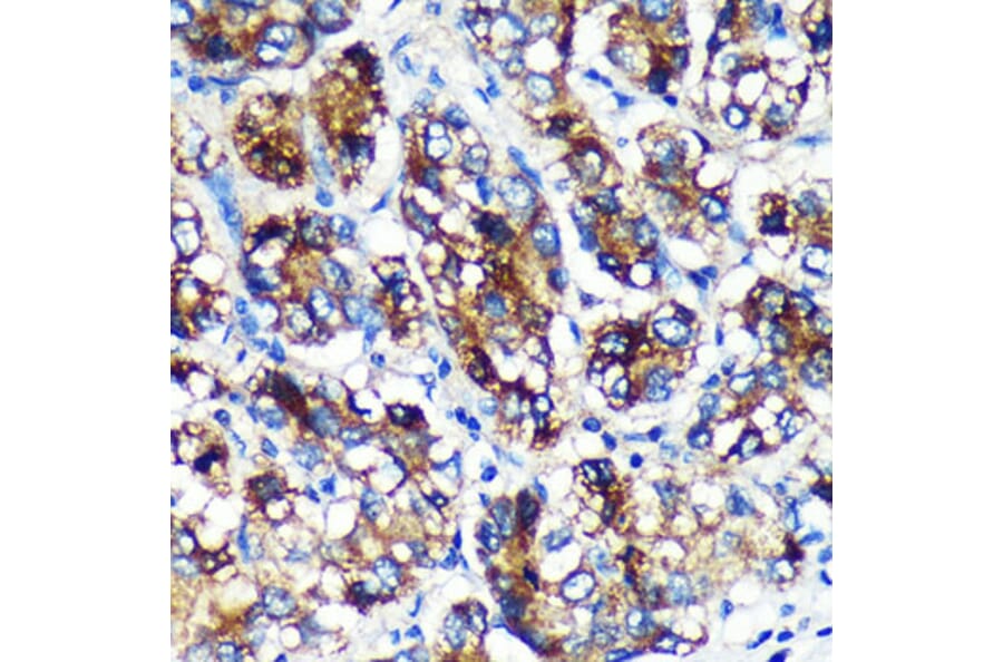 Immunohistochemistry - Anti-EML4 Antibody (A92590) - Antibodies.com