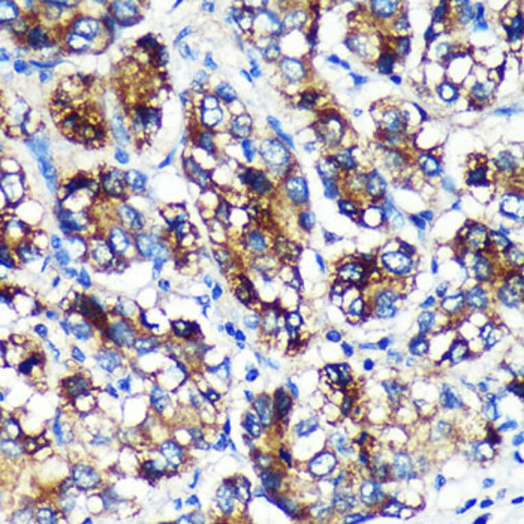 Immunohistochemistry - Anti-EML4 Antibody (A92590) - Antibodies.com