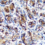 Immunohistochemistry - Anti-EML4 Antibody (A92590) - Antibodies.com