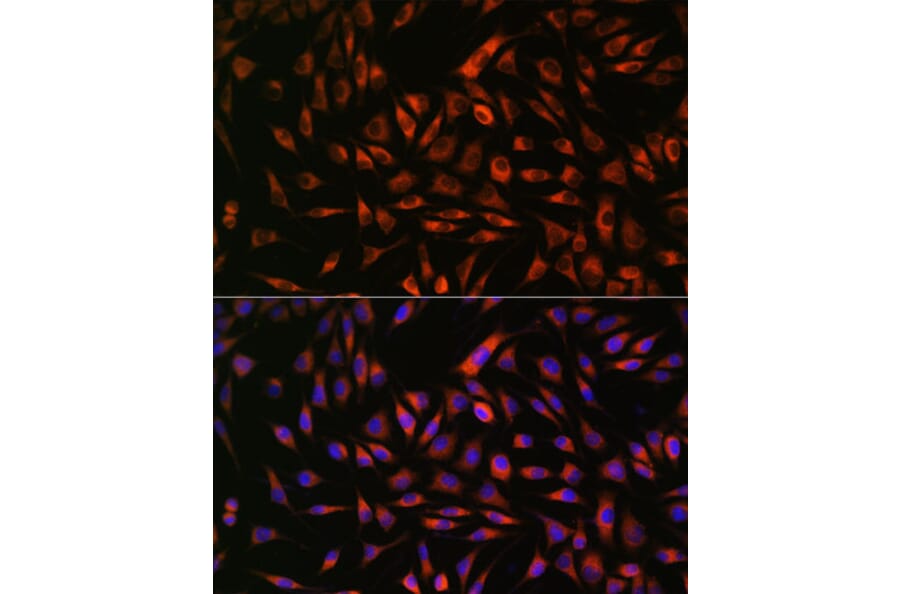 Anti-EML4 Antibody (A92590) | Antibodies.com