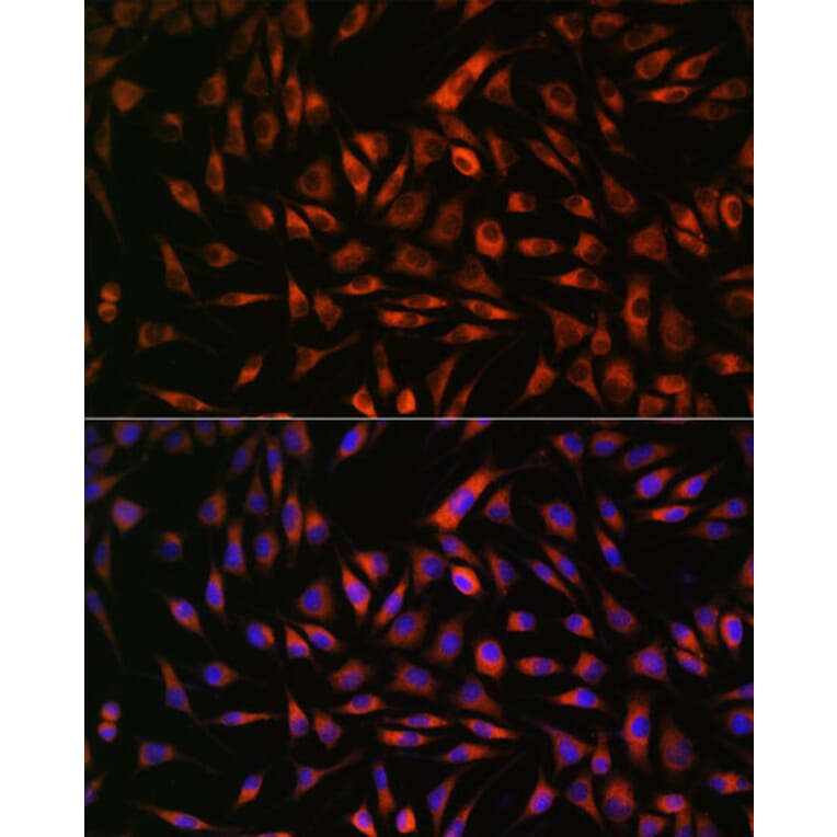 Immunofluorescence - Anti-EML4 Antibody (A92590) - Antibodies.com