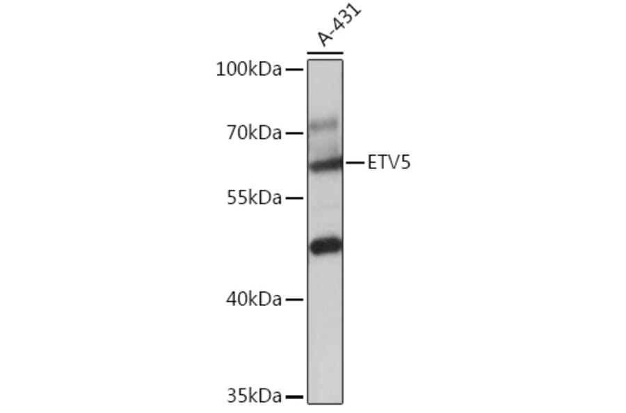 Western Blot - Anti-ERM/Etv5 Antibody (A92592) - Antibodies.com