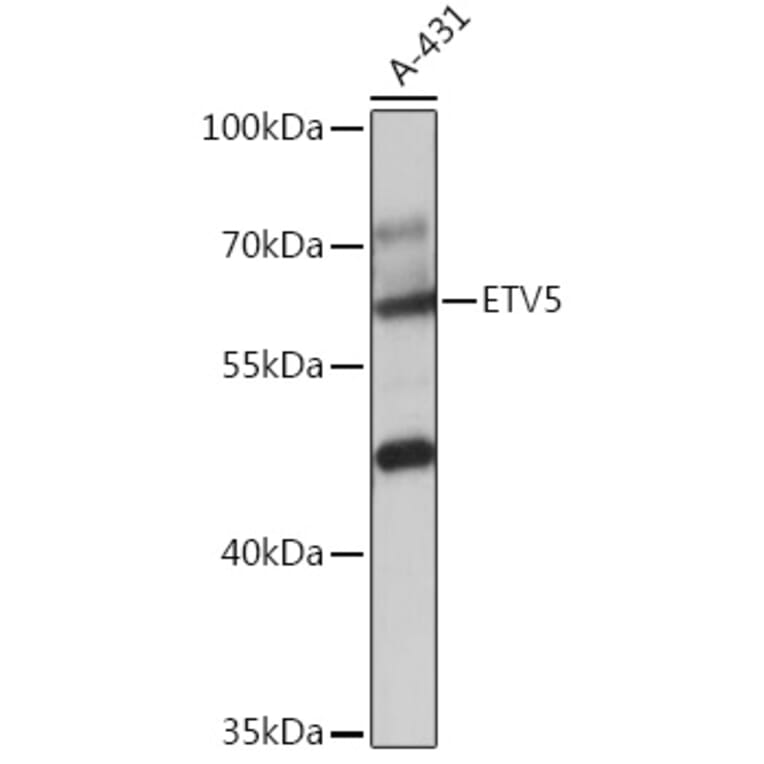 Western Blot - Anti-ERM/Etv5 Antibody (A92592) - Antibodies.com