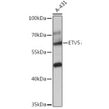 Western Blot - Anti-ERM/Etv5 Antibody (A92592) - Antibodies.com