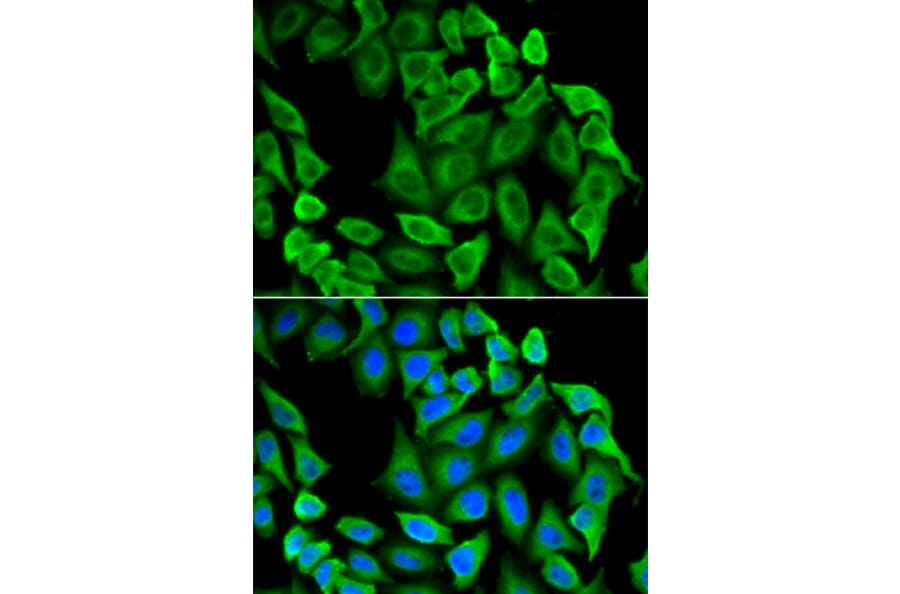 Immunofluorescence - Anti-Fas Antibody (A92593) - Antibodies.com