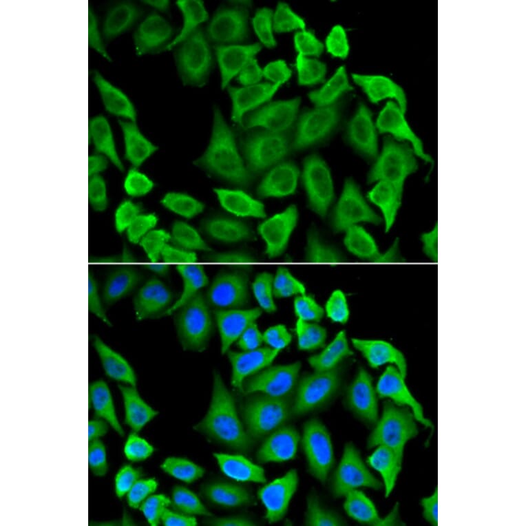 Immunofluorescence - Anti-Fas Antibody (A92593) - Antibodies.com