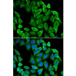 Immunofluorescence - Anti-Fas Antibody (A92593) - Antibodies.com