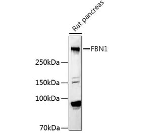 Western Blot - Anti-Fibrillin 1 Antibody (A92595) - Antibodies.com