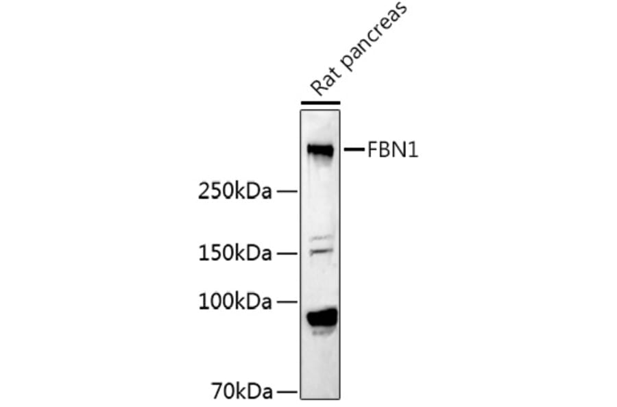 Western Blot - Anti-Fibrillin 1 Antibody (A92595) - Antibodies.com