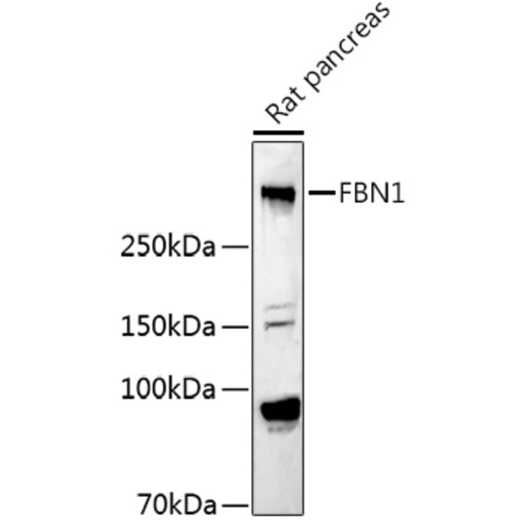 Western Blot - Anti-Fibrillin 1 Antibody (A92595) - Antibodies.com