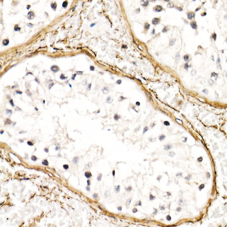 Immunohistochemistry - Anti-Fibrillin 1 Antibody (A92595) - Antibodies.com