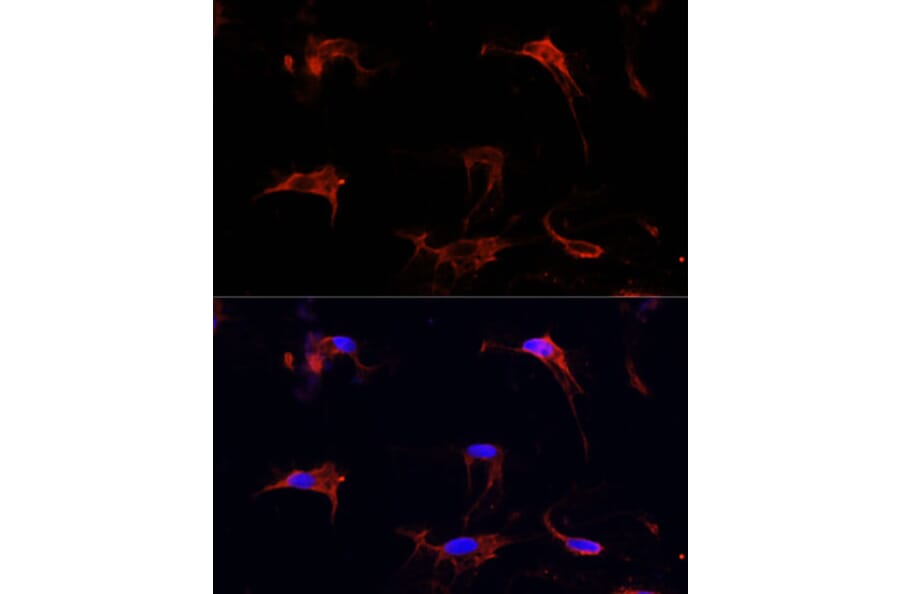 Immunofluorescence - Anti-Fibrillin 1 Antibody (A92595) - Antibodies.com