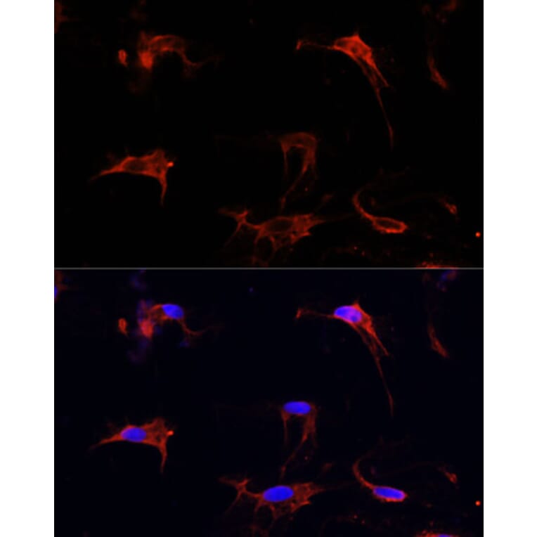 Immunofluorescence - Anti-Fibrillin 1 Antibody (A92595) - Antibodies.com
