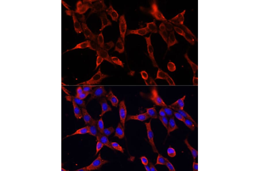 Immunofluorescence - Anti-Fibrillin 1 Antibody (A92595) - Antibodies.com