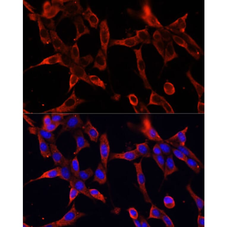 Immunofluorescence - Anti-Fibrillin 1 Antibody (A92595) - Antibodies.com