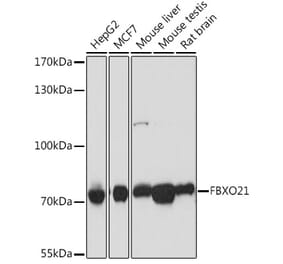 Western Blot - Anti-FBXO21 Antibody (A92596) - Antibodies.com