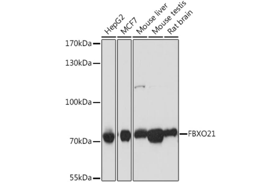 Western Blot - Anti-FBXO21 Antibody (A92596) - Antibodies.com