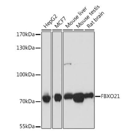 Western Blot - Anti-FBXO21 Antibody (A92596) - Antibodies.com