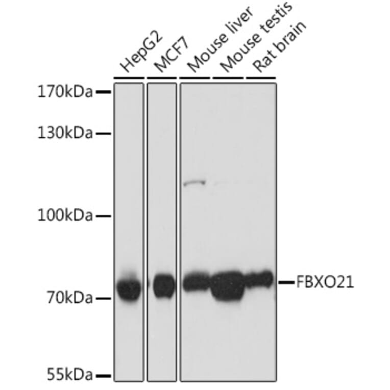 Western Blot - Anti-FBXO21 Antibody (A92596) - Antibodies.com