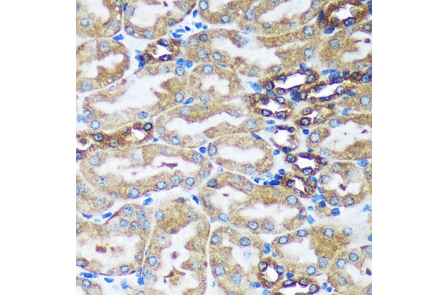 Immunohistochemistry - Anti-FBXO21 Antibody (A92596) - Antibodies.com