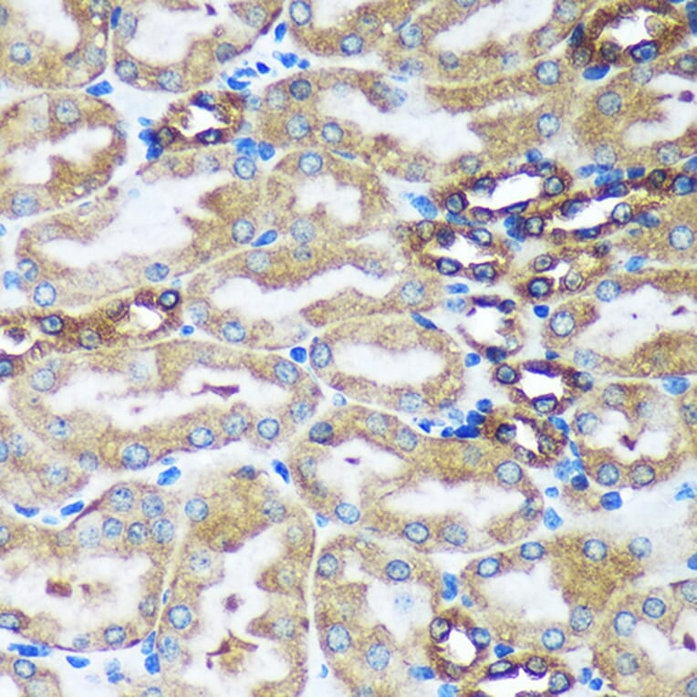 Immunohistochemistry - Anti-FBXO21 Antibody (A92596) - Antibodies.com