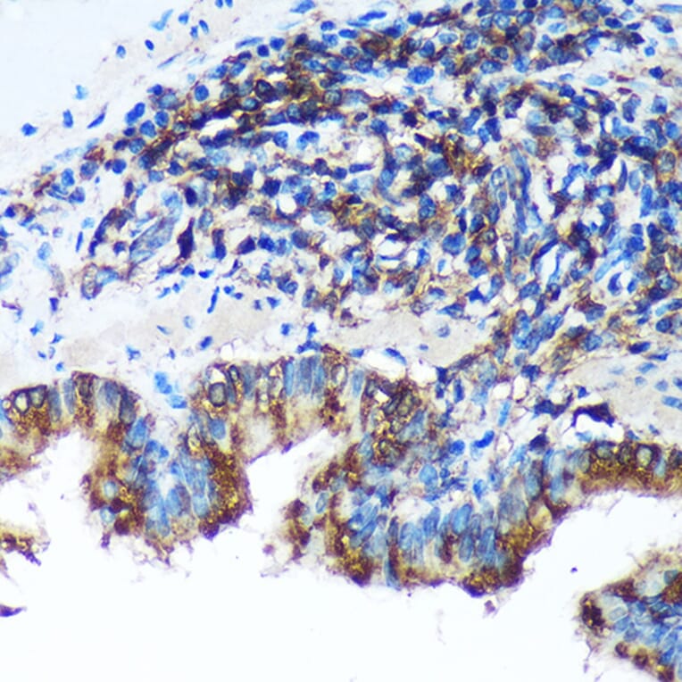 Immunohistochemistry - Anti-FBXO21 Antibody (A92596) - Antibodies.com