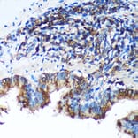 Immunohistochemistry - Anti-FBXO21 Antibody (A92596) - Antibodies.com