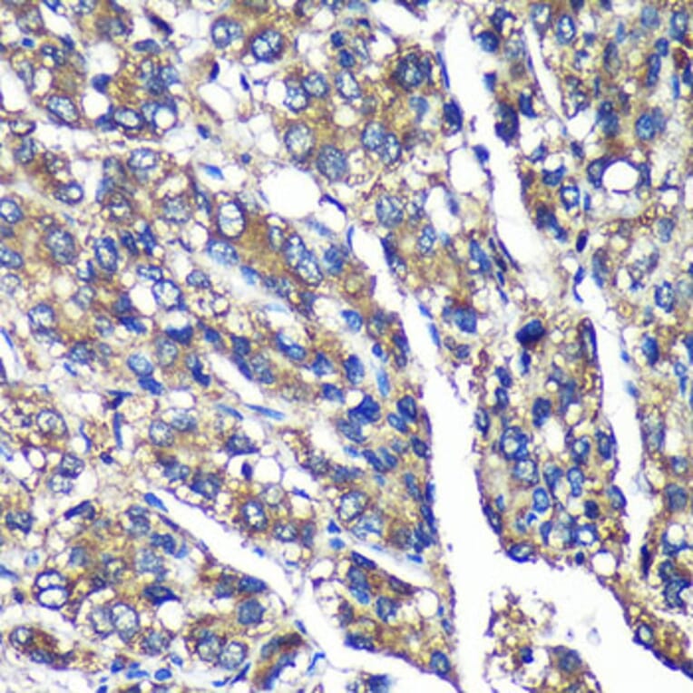 Immunohistochemistry - Anti-FBXO21 Antibody (A92596) - Antibodies.com