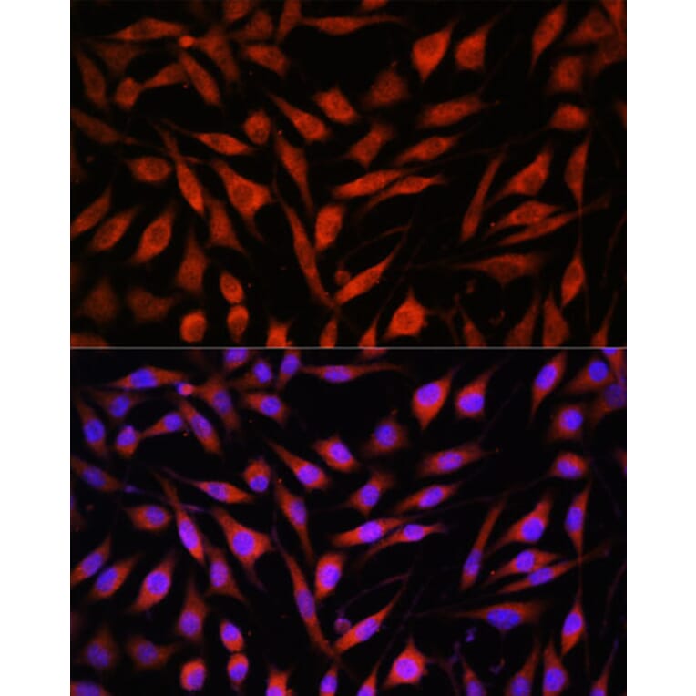 Immunofluorescence - Anti-FBXO21 Antibody (A92596) - Antibodies.com