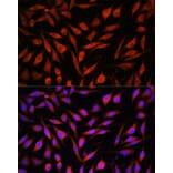 Immunofluorescence - Anti-FBXO21 Antibody (A92596) - Antibodies.com