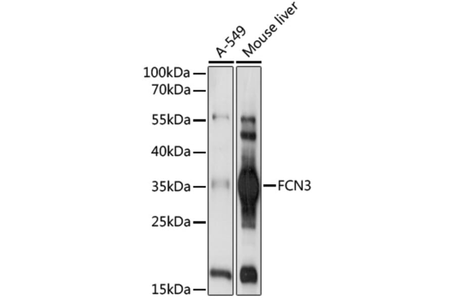 Western Blot - Anti-FCN3 Antibody (A92597) - Antibodies.com
