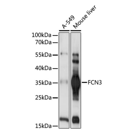 Western Blot - Anti-FCN3 Antibody (A92597) - Antibodies.com