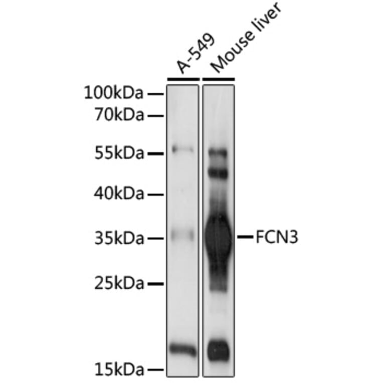Western Blot - Anti-FCN3 Antibody (A92597) - Antibodies.com