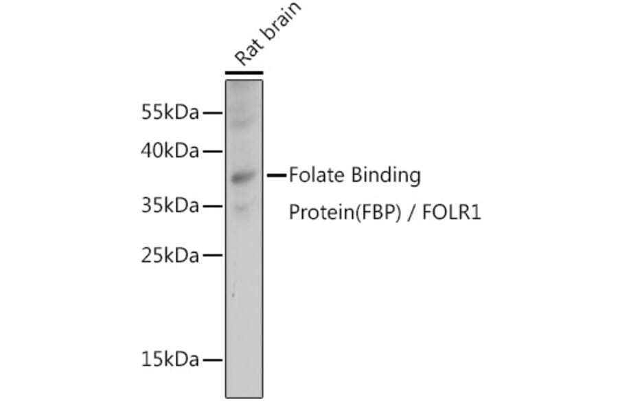 Western Blot - Anti-Folate Binding Protein/FBP Antibody (A92599) - Antibodies.com