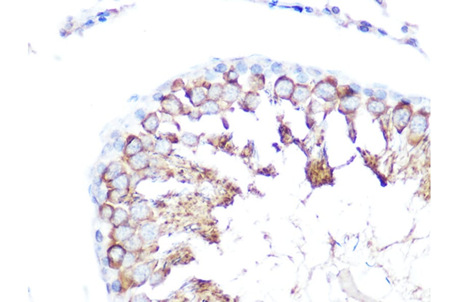Immunohistochemistry - Anti-Folate Binding Protein/FBP Antibody (A92599) - Antibodies.com