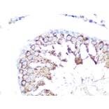 Immunohistochemistry - Anti-Folate Binding Protein/FBP Antibody (A92599) - Antibodies.com