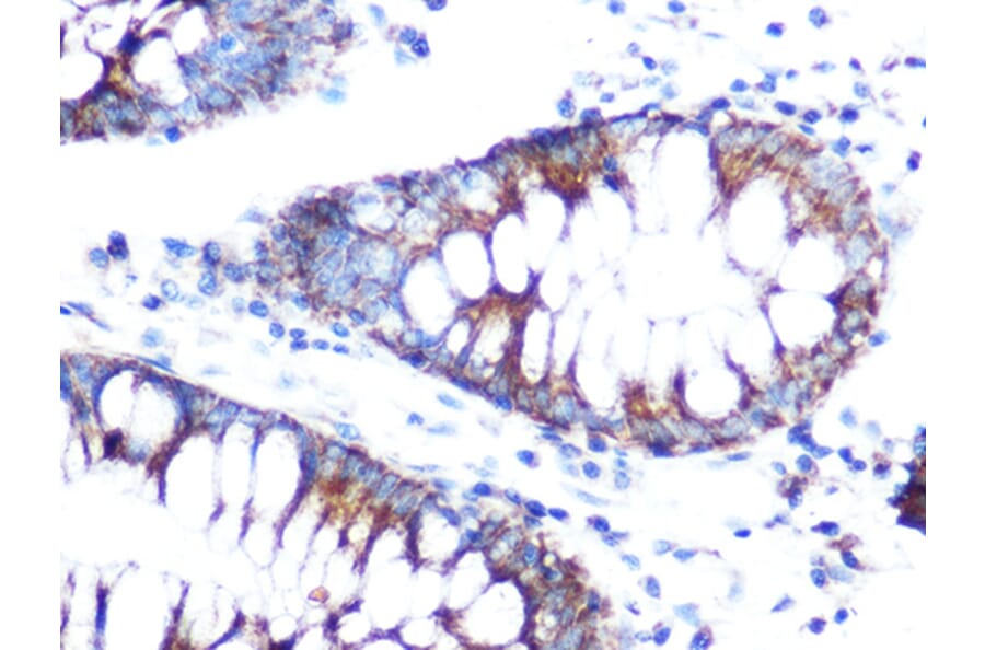 Immunohistochemistry - Anti-Folate Binding Protein/FBP Antibody (A92599) - Antibodies.com